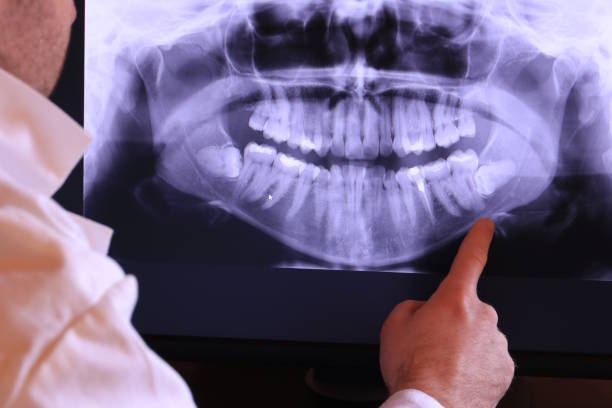 Best Dentist for Tooth Abscess  in Canon, GA