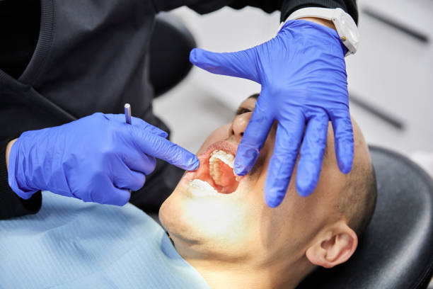 Best Emergency Gum Pain Relief  in Canon, GA