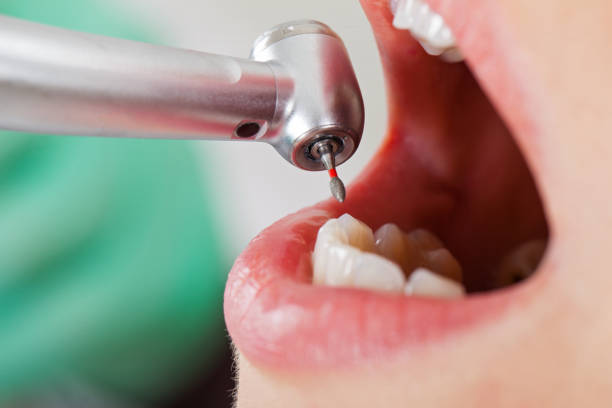 Best Tooth Pain Emergency Relief  in Canon, GA